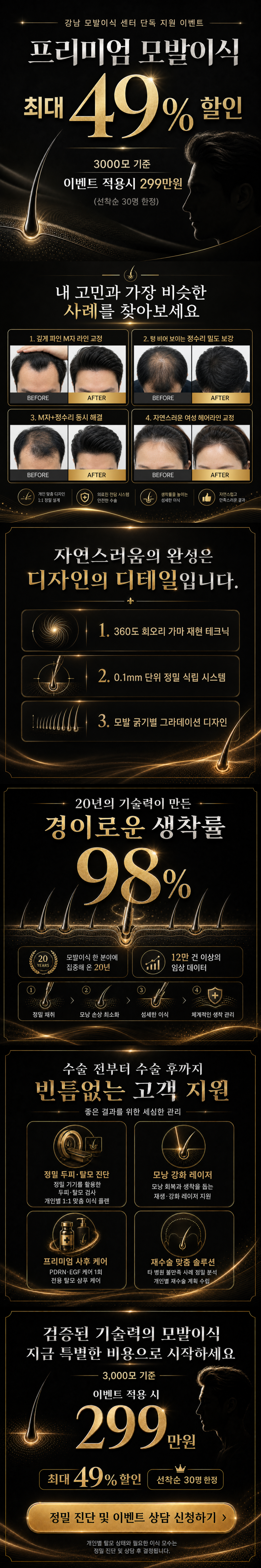 모발이식 상담 신청